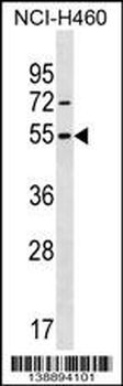 MIER1 Antibody (Center)