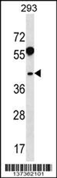 RRAGB Antibody (N-term)