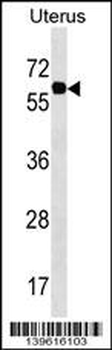 PGM3 Antibody (Center)