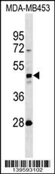 KRT31 Antibody (N-term)