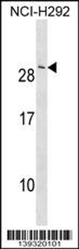 CRADD Antibody (Center)