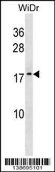 ATP5L2 Antibody (N-term)