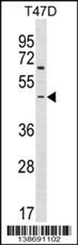 ARHGEF35 Antibody (Center)