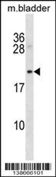 Rat Mycb Antibody (C-term)