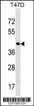 HOXD8 Antibody (C-term)