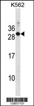Mouse Rab17 Antibody (Center)
