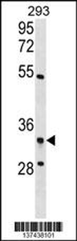 RPF2 Antibody (C-term)
