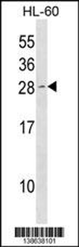 Mouse Cdkn1b Antibody (N-term)