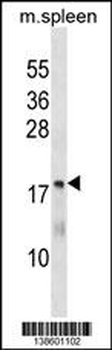 MTHFS Antibody (C-term)