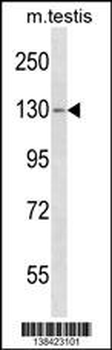 TBC1D2 Antibody (Center)