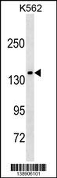 MLLT2 Antibody (C-term T1196)