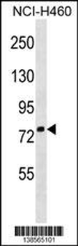 ZNF607 Antibody (Center)