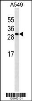 ISOC2 Antibody (C-term)
