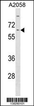 KLHL14 Antibody (Center)