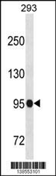 SFMBT1 Antibody (N-term)