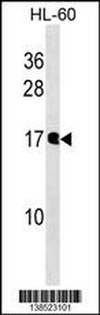 NUDT10 Antibody (N-term)