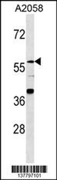 ZNF776 Antibody (N-term)