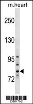 TBCK Antibody (N-term)