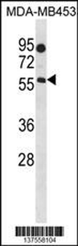 B4GALNT1 Antibody (Center)