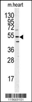 ATG14 Antibody (N-term)