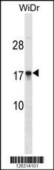 CDRT4 Antibody (Center)