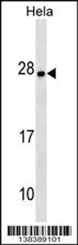 ZMAT4 Antibody (N-term)