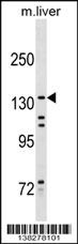 KIF15 Antibody (Center)