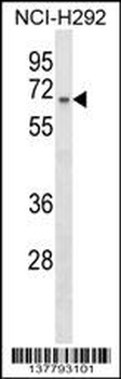 ZNF682 Antibody (Center)