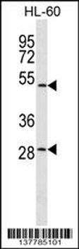 ZNF324 Antibody (C-term)