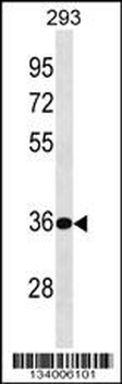BPHL Antibody (Center)