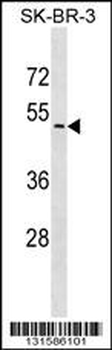 UGT2B7 Antibody (N-term)
