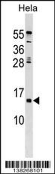 HHLA3 Antibody (Center)