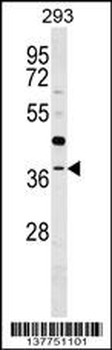 RG9MTD3 Antibody (Center)