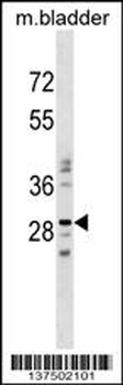 NUBPL Antibody (N-term)