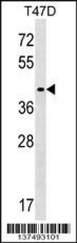 MMADHC Antibody (C-term)