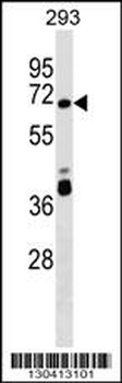 ZNF79 Antibody (N-term)
