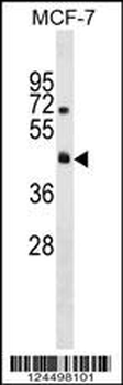 R4RL2 Antibody (C-term)