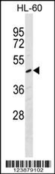 F2R Antibody (N-term)