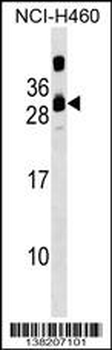 CIB3 Antibody (N-term)