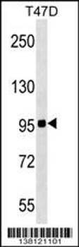ZNF606 Antibody (N-term)