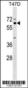 ZNF554 Antibody (Center)