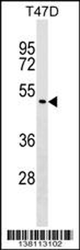 ZNF557 Antibody (N-term)
