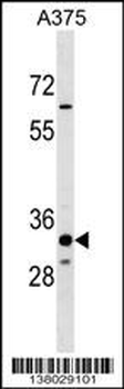 THEM5 Antibody (Center)