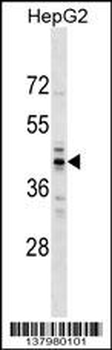 RG9MTD2 Antibody (Center)