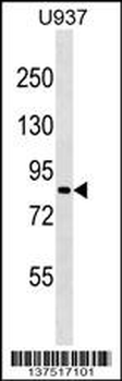 ZNF225 Antibody (N-term)