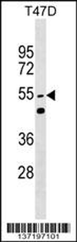 HNRPLL Antibody (N-term)
