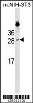 RAB39B Antibody (N-term)
