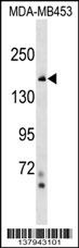 NFKBIL2 Antibody (N-term)