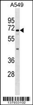 ITFG1 Antibody (C-term)