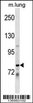 DACH1 Antibody (Center)